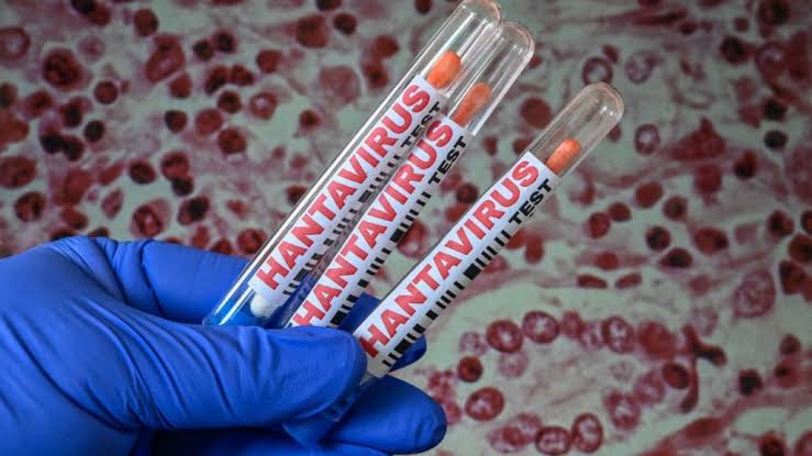 Hantavirus
