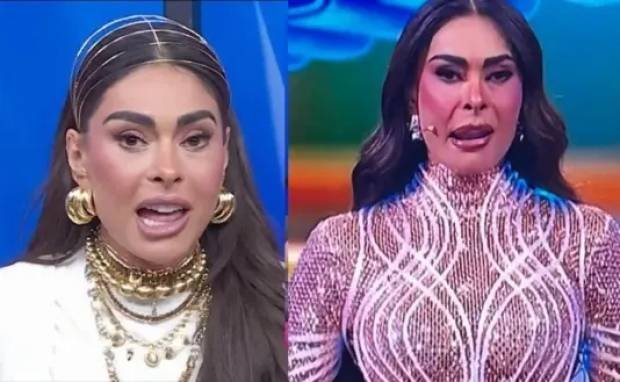 Galilea Montijo revela los detalles de su procedimiento estético fallido.