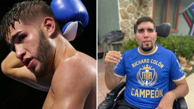 Golpes de conejo: la lesión que terminó con la carrera del boxeador Prichard Colón.