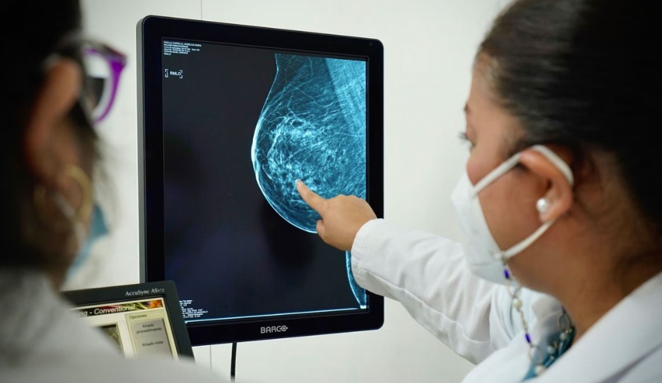 Desarrollan IA que agiliza detección de cáncer